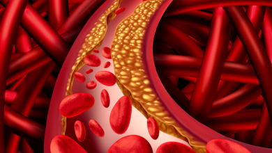 Photo of High Cholesterol Problem: कोलेस्ट्रॉल को कंट्रोल रखती हैं ये चार चीजें, खाने में जरूर करें शामिल